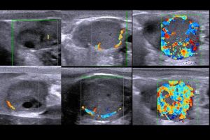 Detection of open cows by Color-Flow Doppler Ultrasound