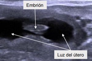 GnRH injection to reduce pregnancy losses in dairy cattle embryo transfer