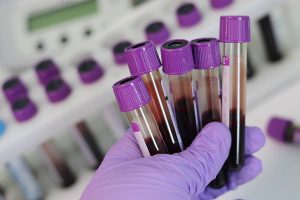 A hand holding test tubes filled with blood